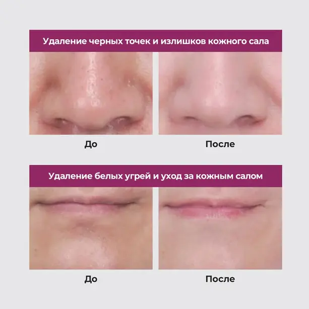 NEOGEN Pore Tight Peelşng Mousse